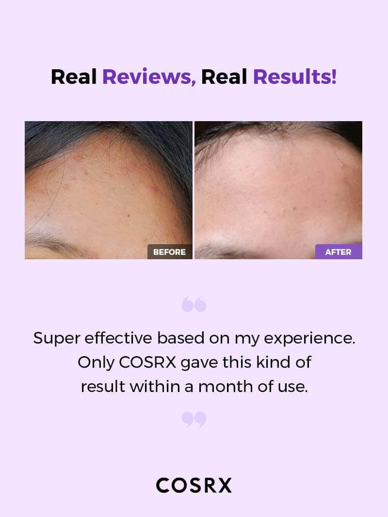 COSRX AHA/BHA Clarifying Treatment Toner (150ml)